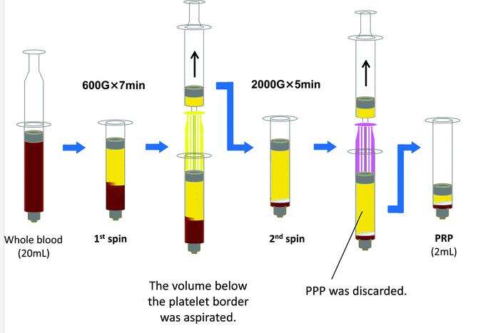 Compact Laboratory Centrfiuge Horzio<em></em>nal Rotor PRP kit  For Medical L-600A