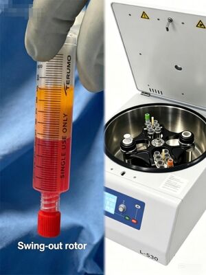 Quality  CENTRIFUGE For YES PRP Kit 50/60ml Syringe Fat Transfer LCD Display  4200 rpm factory