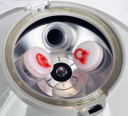 Blood Separation CENTRIFUGE Yescom 6-Place Medical Laboratory Centrifuge