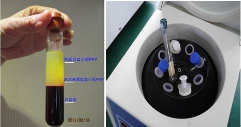 PRP Kit Centrifuge Compact Laboratory Brushless motor Syringe Dental LC-400