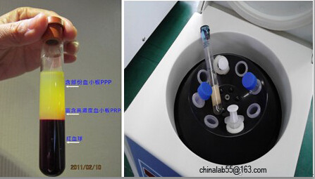 PRP kit Medical Centrifuge 4,000rpm 10ml syringe tube Brushles Motor