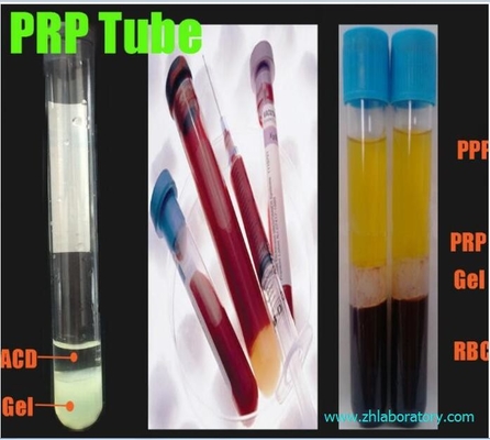 PRP/PRF CENTRIFUGE Equipment Kit PRP platelet rich plasma Medical Laboratory Centrifuge